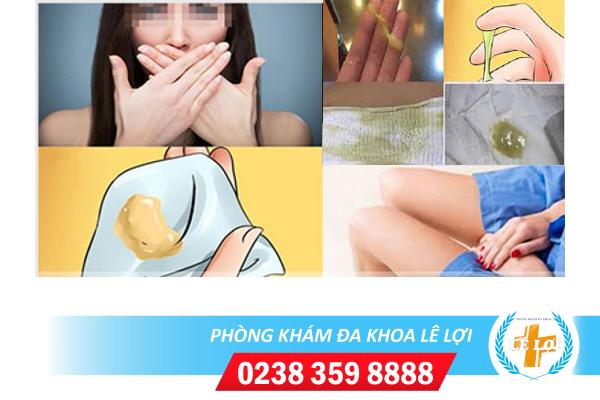 Ra dịch âm đạo màu vàng có phải mắc bệnh phụ khoa?