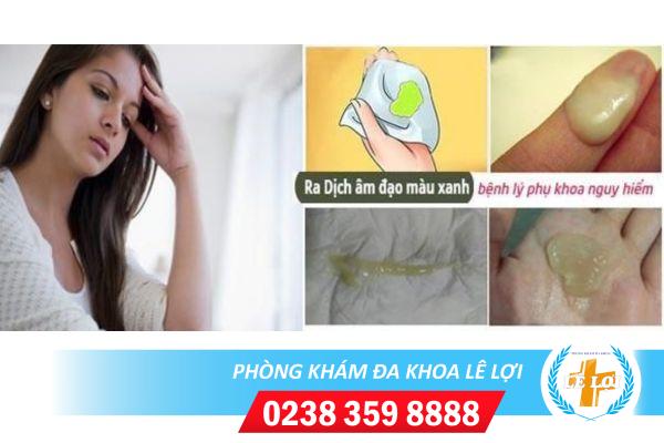 Dịch âm đạo màu xanh nguy hiểm không?