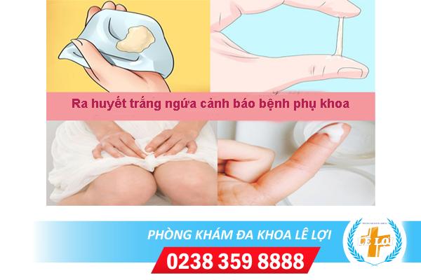 Ra huyết trắng ngứa là bị gì?