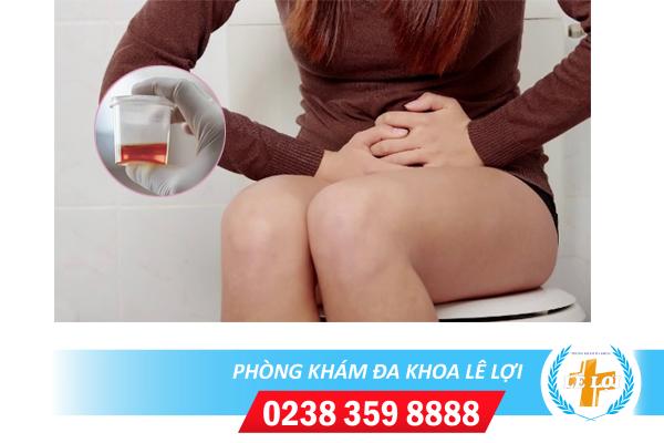 Tiểu buốt ra máu ở nữ là bệnh gì nguy hiểm không?