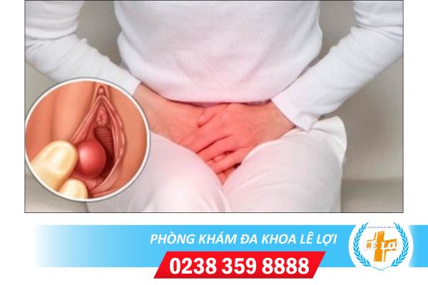 Dấu hiệu nhận biết viêm tuyến bartholin và cách chữa trị