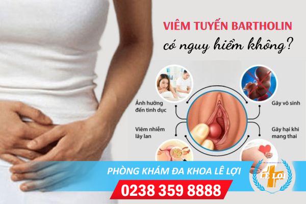 Viêm tuyến bartholin có nguy hiểm không?