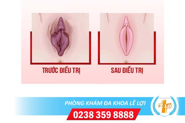 Thu nhỏ môi bé môi lớn ở đâu tại Vinh Nghệ An?