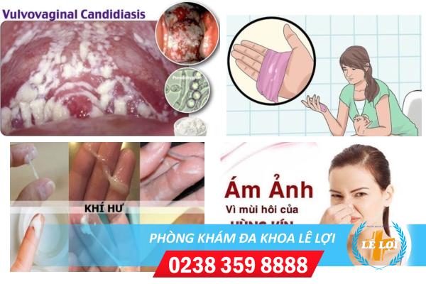 Dấu hiệu viêm hột le và cách điều trị