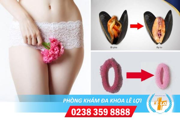 Tân trang âm đạo vùng kín bí quyết giữ lửa phòng the