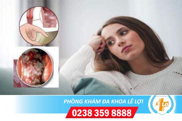 Viêm ngứa vùng kín âm đạo điều trị thế nào?