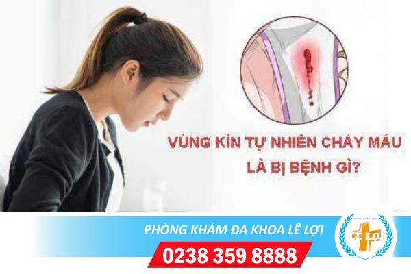 Vùng kín tự nhiên chảy máu nhưng không phải kinh nguyệt