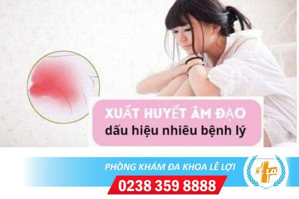 Xuất huyết âm đạo là dấu hiệu bệnh gì?