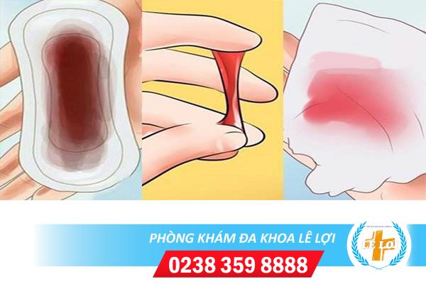 Âm đạo ra máu bất thường là bệnh gì?