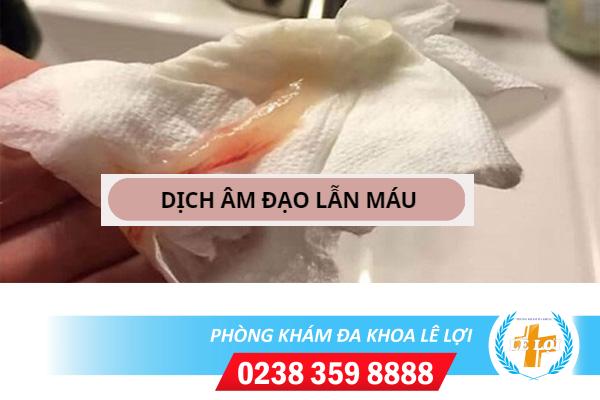 Dịch âm đạo lẫn máu là bị bệnh gì?