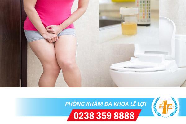 Nước tiểu vàng đục là bị bệnh gì?