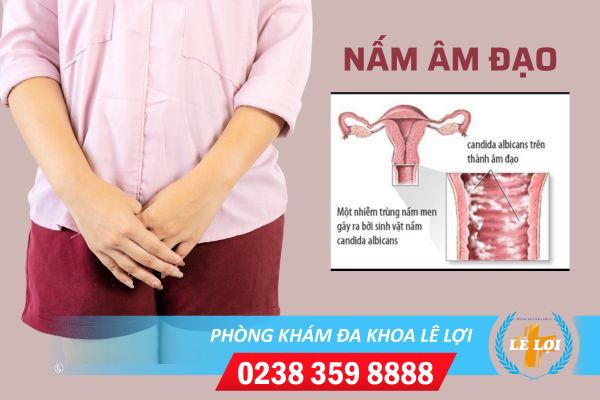 Các loại nấm âm đạo & nguyên nhân