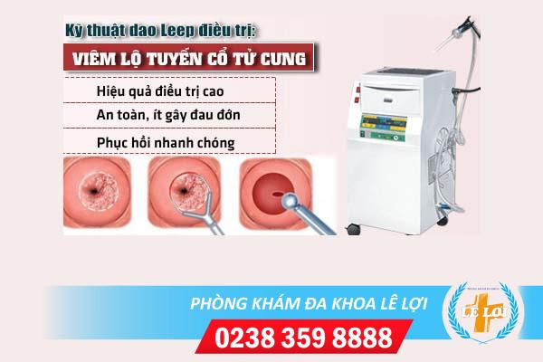 Chi phí cắt leep cổ tử cung hiện nay bao nhiêu?