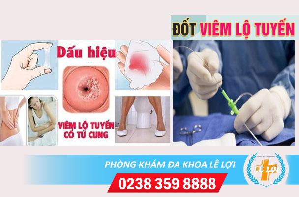 Thông tin về chi phí đốt điện cổ tử cung