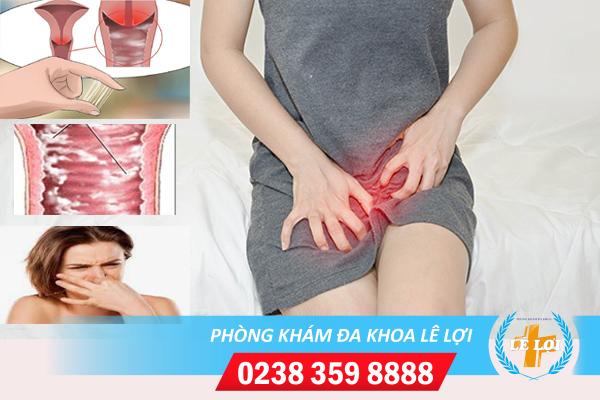 Những nguyên nhân gây nấm vùng kín thường gặp