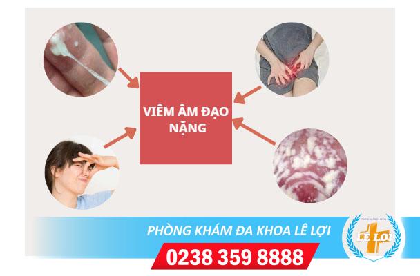 Nhận biết dấu hiệu viêm âm đạo nặng