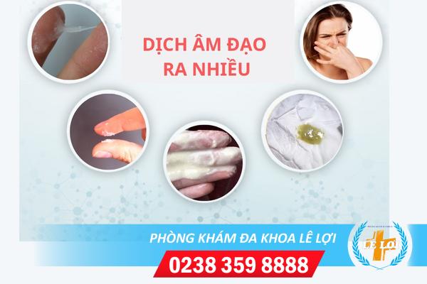 Cách điều trị dịch âm đạo ra nhiều