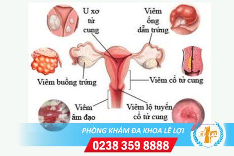 Thuốc chữa viêm nhiễm phụ khoa hiệu quả hiện nay