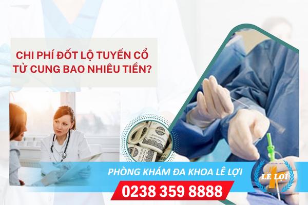 Chi phí đốt lộ tuyến cổ tử cung bao nhiêu tiền?