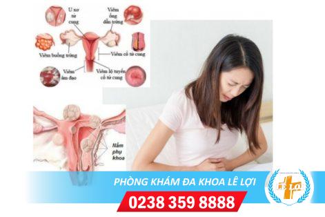 Thuốc đặt phụ khoa, chữa bệnh hiệu quả